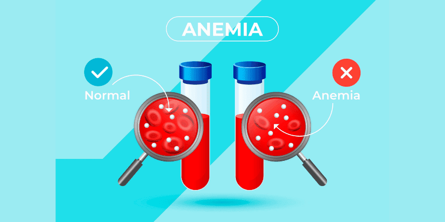 Causes of Anemia